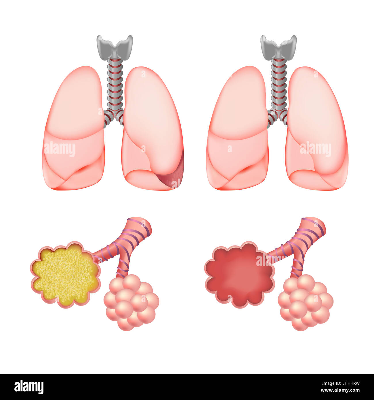 Alveoli in polmoni impostato Foto Stock