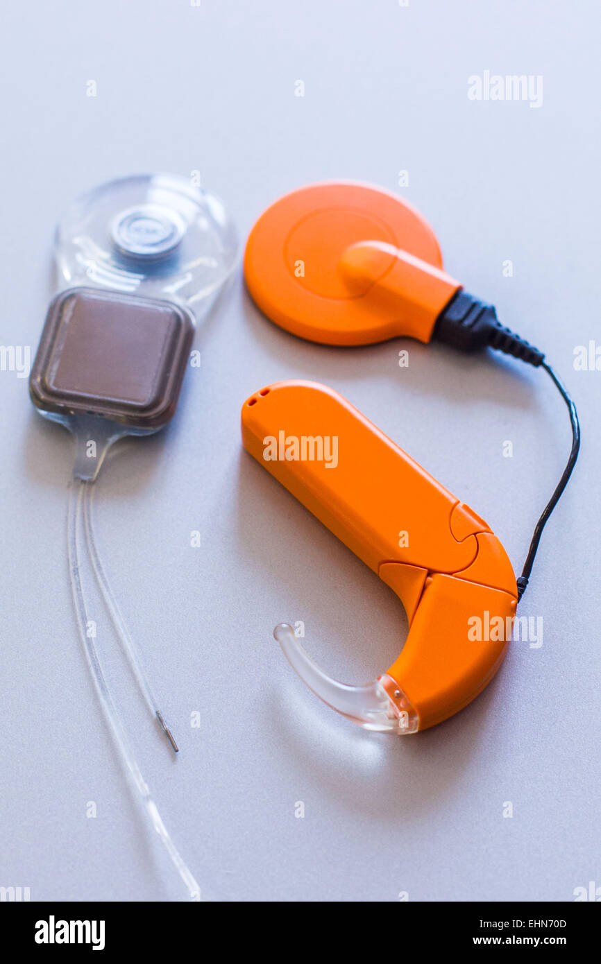 Il ricevitore e la schiera di elettrodi componenti di un impianto cocleare (CI) per pazienti sordi. Foto Stock
