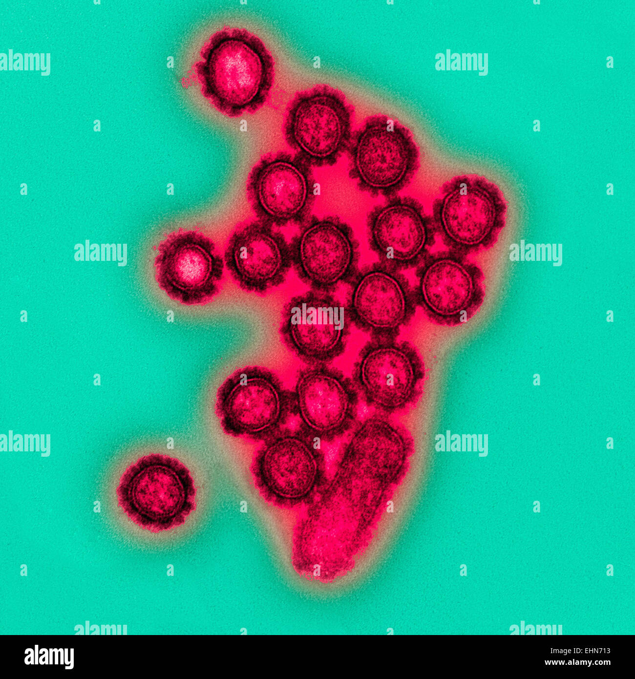 H1N1 virus influenzali di particella, microscopio elettronico a trasmissione (TEM). Foto Stock