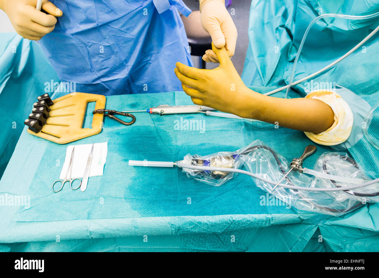 Artroscopica chirurgia del polso, Jouvenet clinic, Paris, Francia. Foto Stock