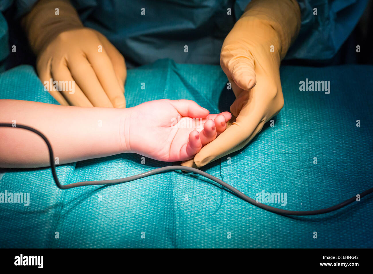 Chirurgia della mano. Foto Stock
