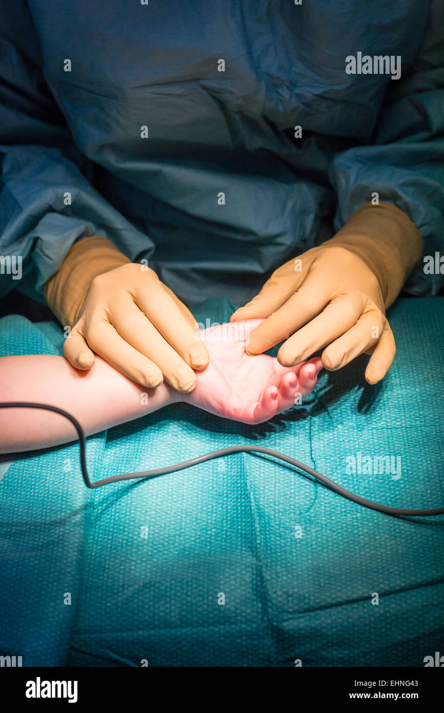Chirurgia della mano. Foto Stock