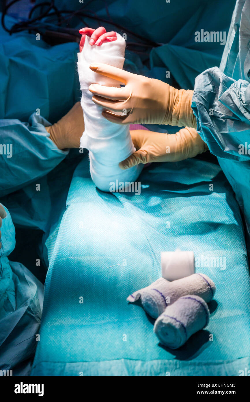 La posa di un bendaggio dopo chirurgia della mano. Foto Stock