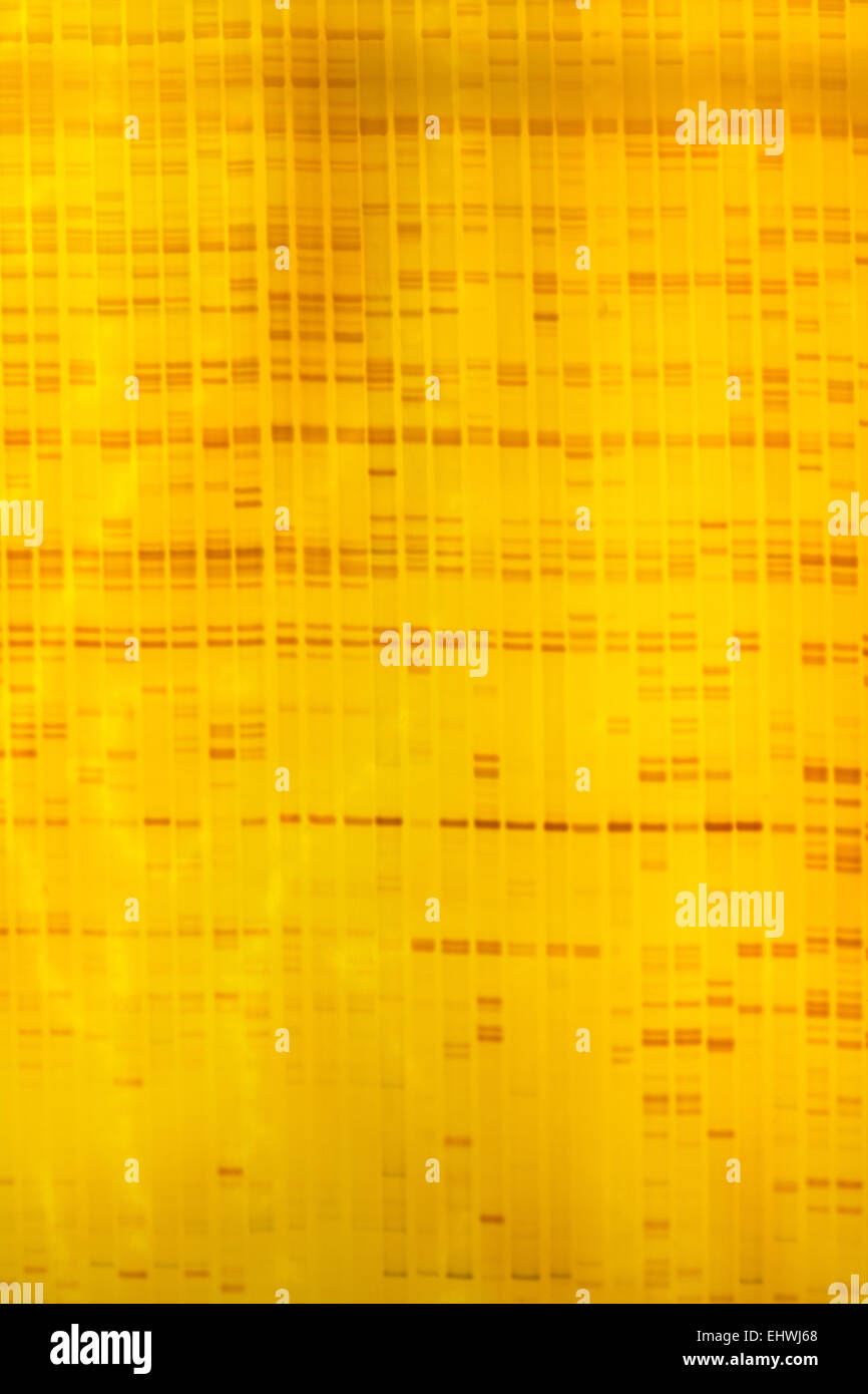 Impianto di impronte digitali di DNA su gel acrylamine risultato di elettroforesi Foto Stock