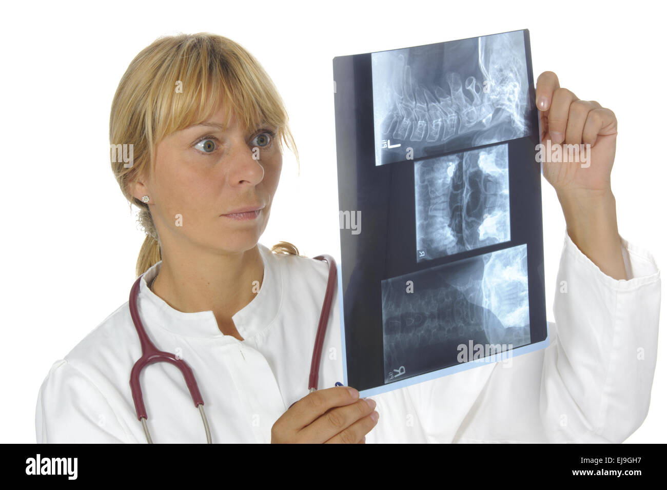 Medico donna con pellicola a raggi x Foto Stock
