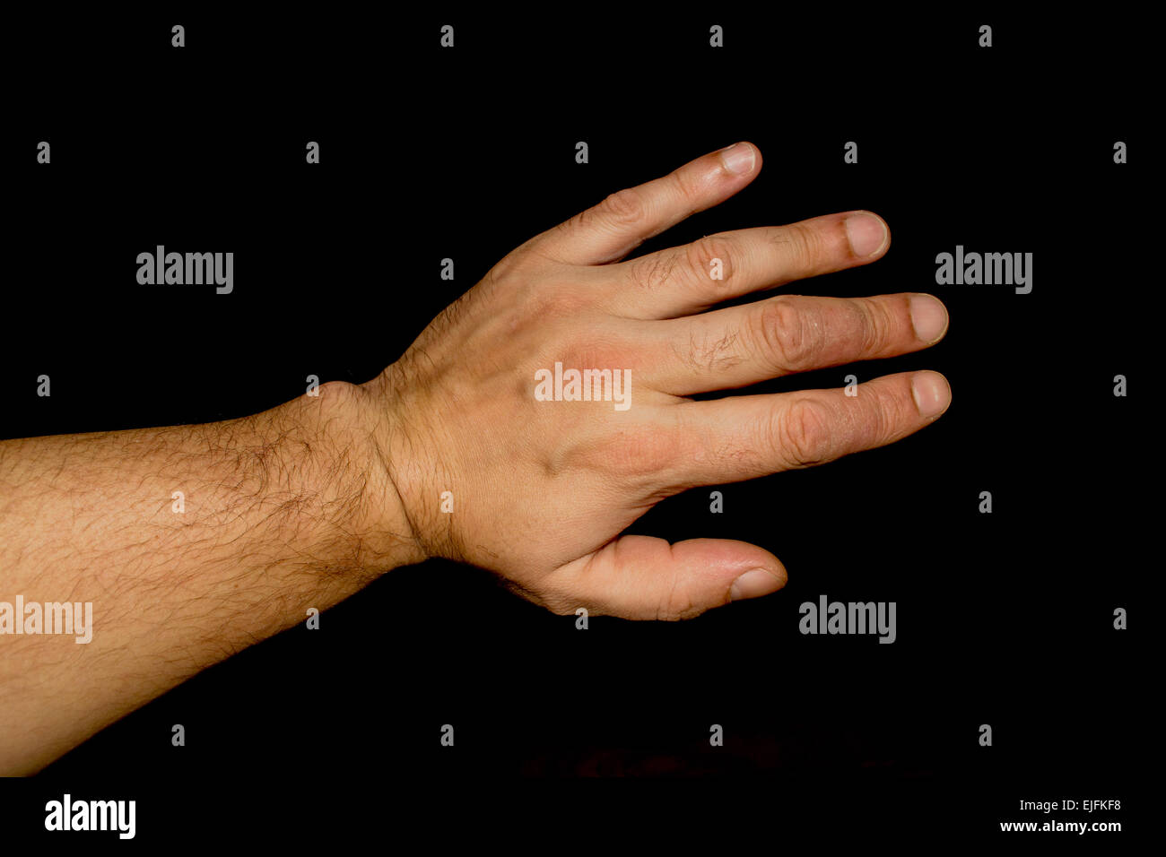 Psoriasi condizione tocca bianco uomo dita Foto Stock