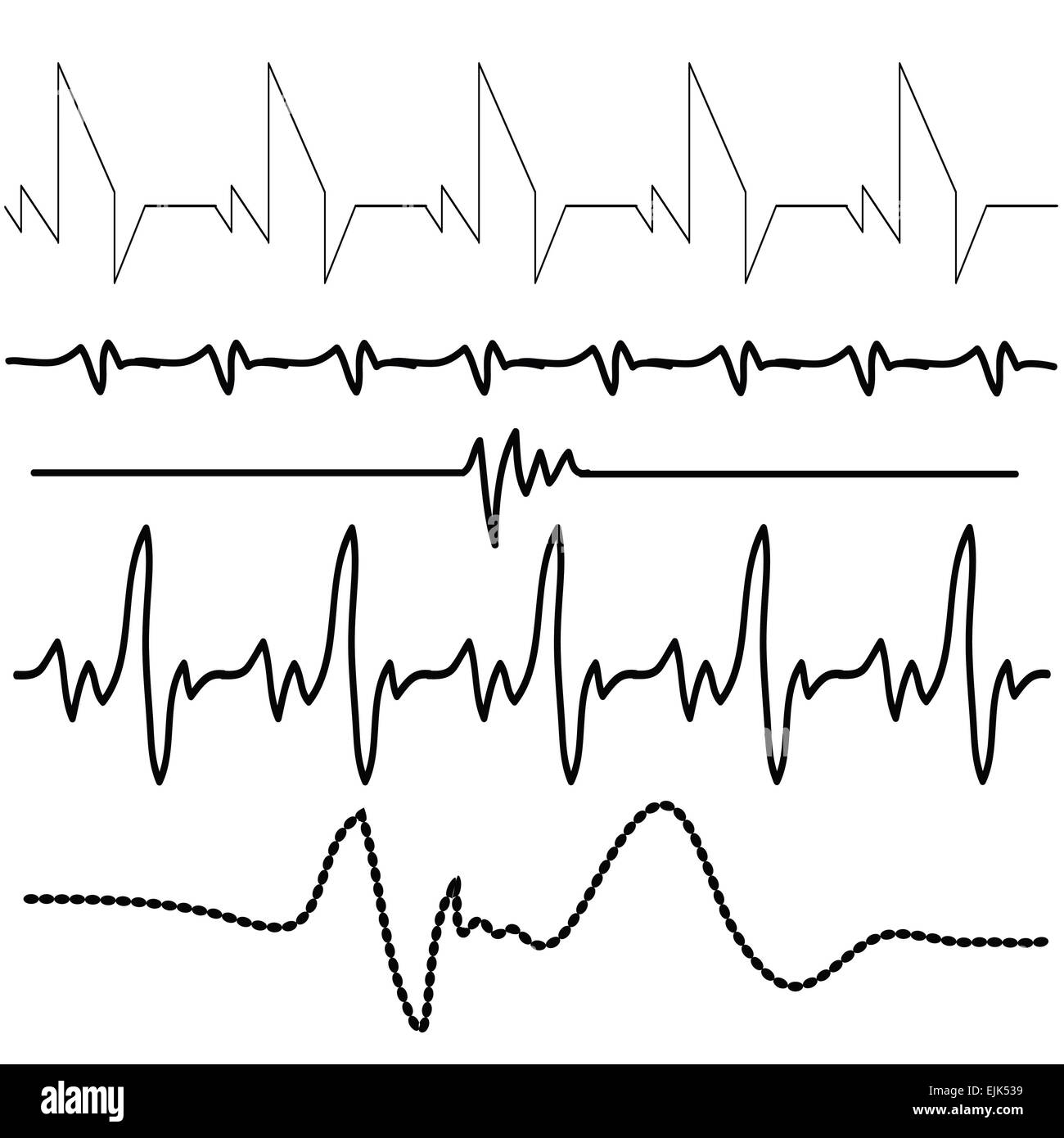 Illustrazione con elettrocardiogramma impostato su sfondo bianco Foto Stock