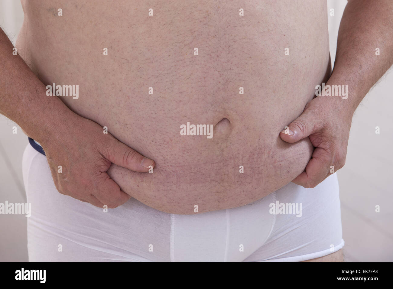 Obesità uomo senior Foto Stock