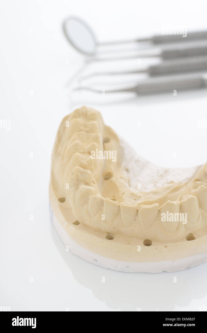 Ortodonzia mascellare o cast utilizzati in odontoiatria shallow fuoco selettivo sulla parte anteriore del cast Foto Stock