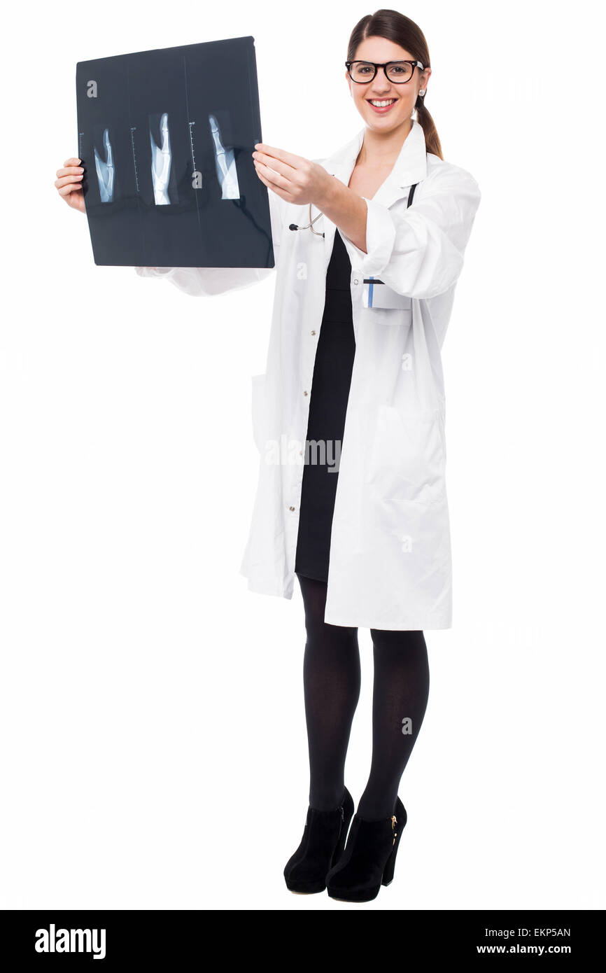 Medico donna revisione del paziente x-ray relazione Foto Stock