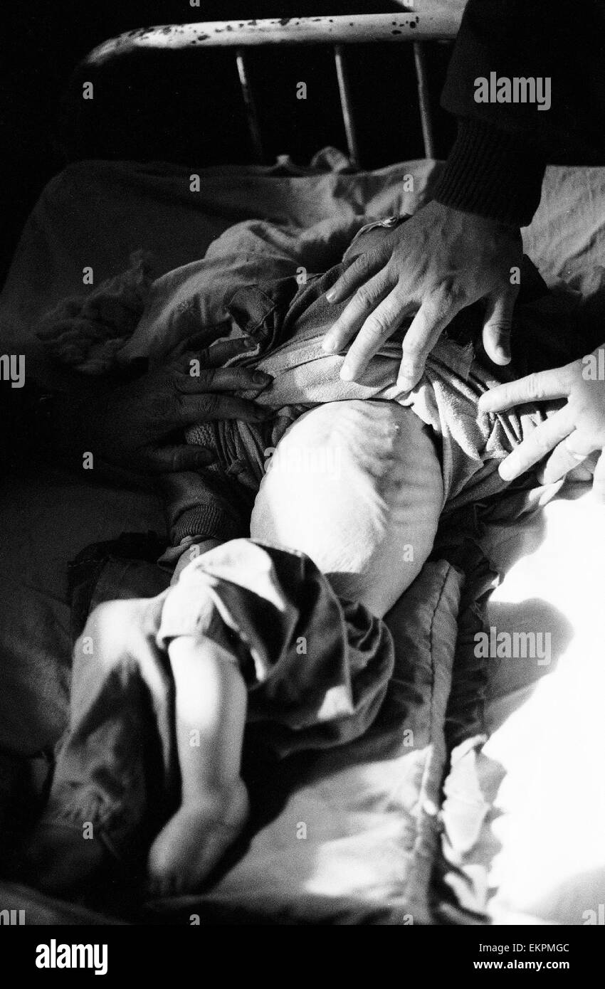 Il bambino malato a Indira Gandhi hospital di Kabul 1994 Afghanistan Foto Stock