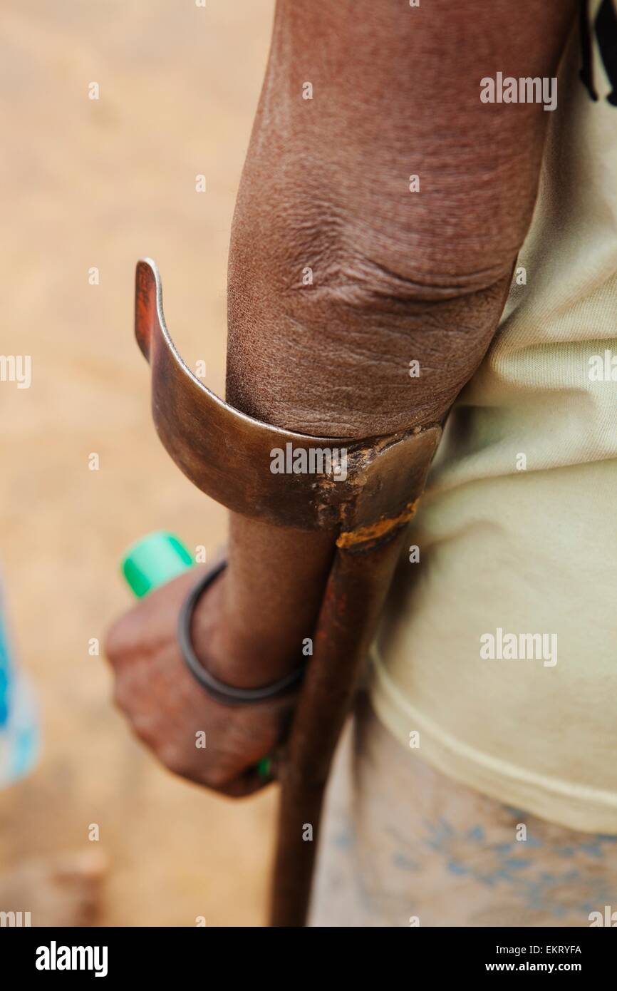 A piedi con una canna con un braccio della staffa di supporto; Manica, Mozambico, Africa Foto Stock