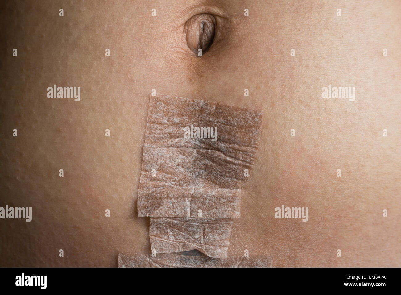 Una madre di recupero di stomaco dopo avere un bambino da c-sezione, coperto con nastro di tipo medico. Foto Stock