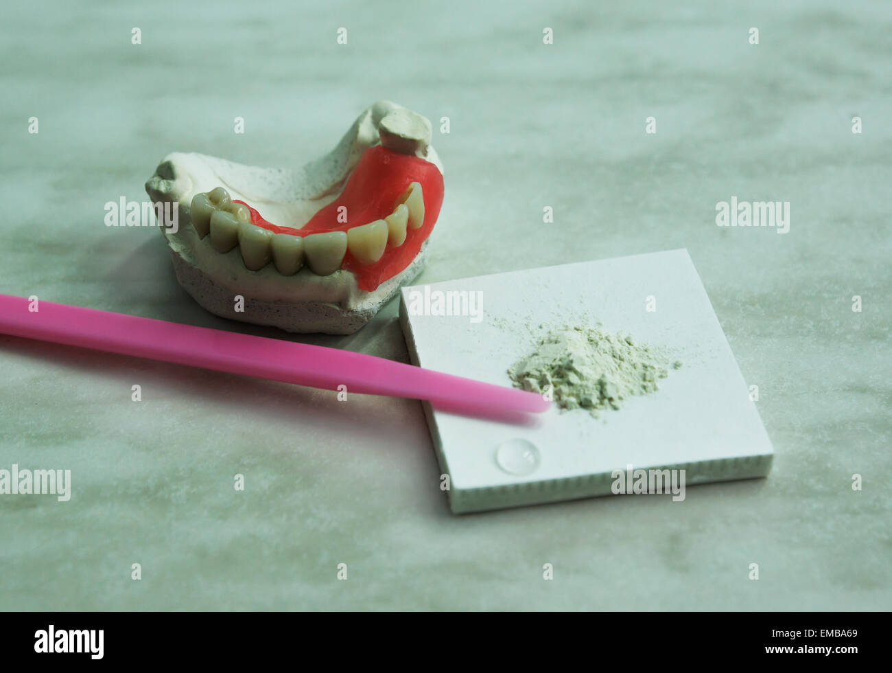 Cemento dentale per il fissaggio delle corone artificiali e ponti in una  cavità orale di pazienti Foto stock - Alamy