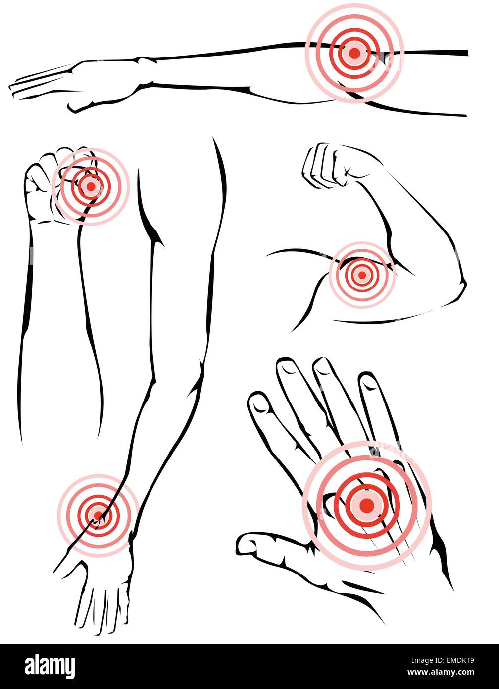 Dolore braccia Illustrazione Vettoriale
