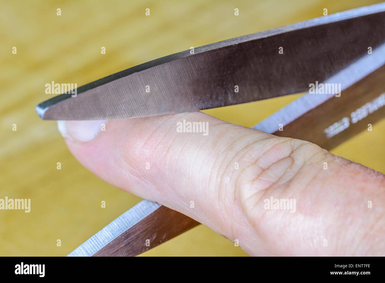 Il taglio di un dito fuori con un paio di forbici. Foto Stock