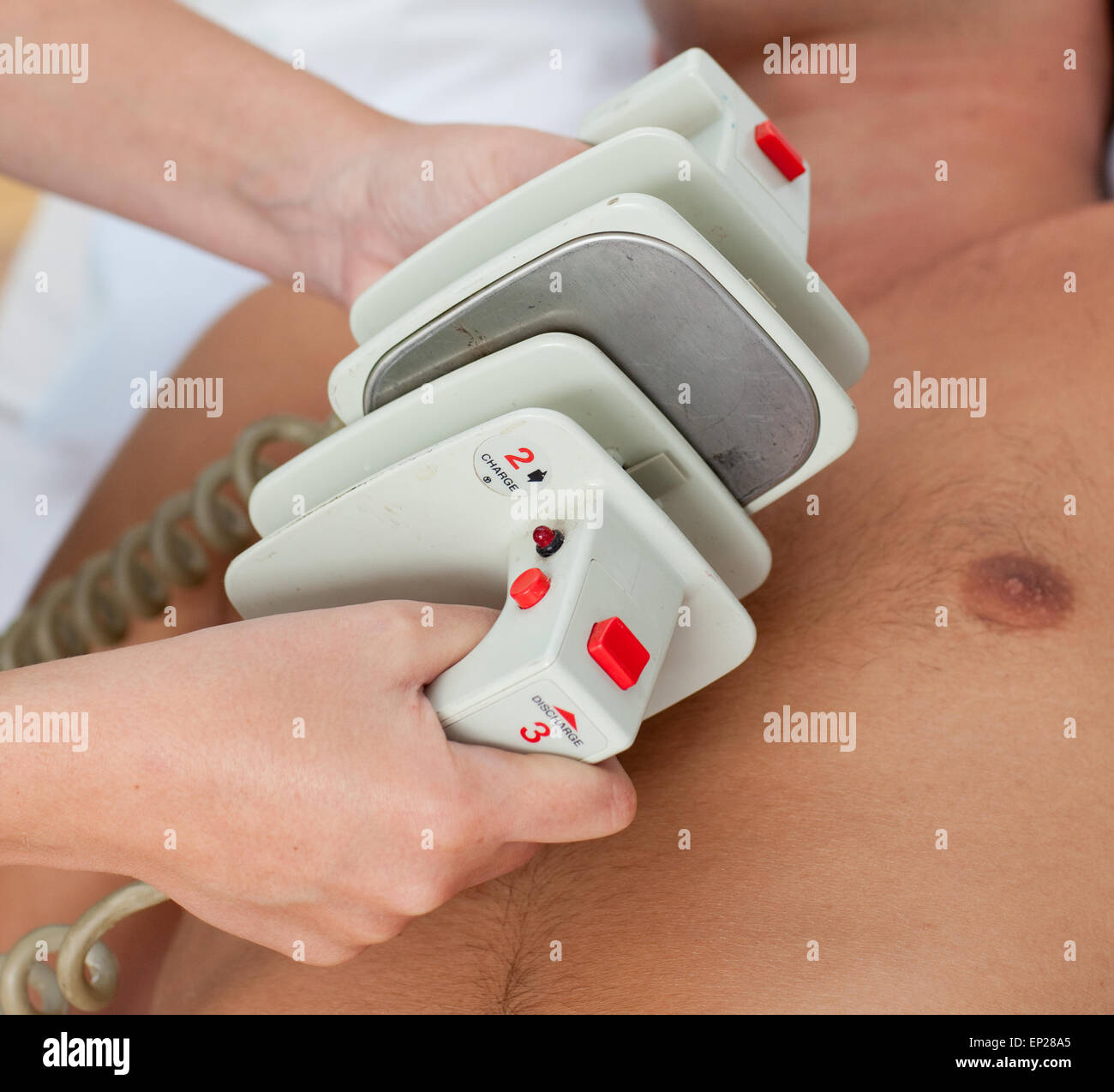 Close-up di un medico prepara una defibrillazione Foto Stock