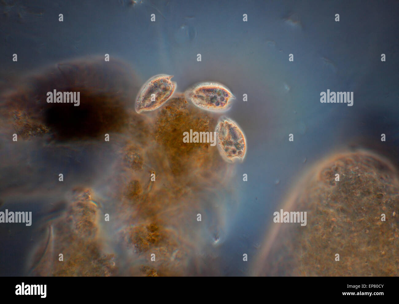 Pondlife, campo oscuro fotomicrografia, odontostome ciliati. Esempi includono Epalxis, Epalxella Saprodinium e. Foto Stock