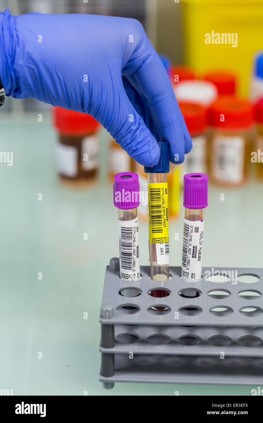 Analisi di piombo nel sangue (avvelenamento da piombo). Laboratorio di Analisi Ambientale Tossicologia e salute sul posto di lavoro. Biologia e centro di ricerca. Foto Stock