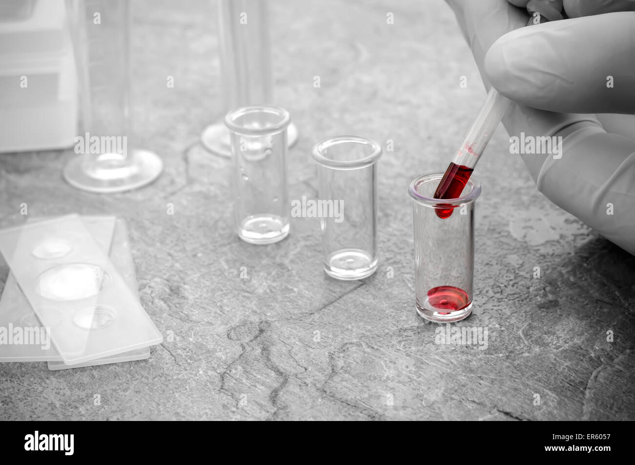 Pipettare campioni di sangue e vassoio di plastica Foto Stock