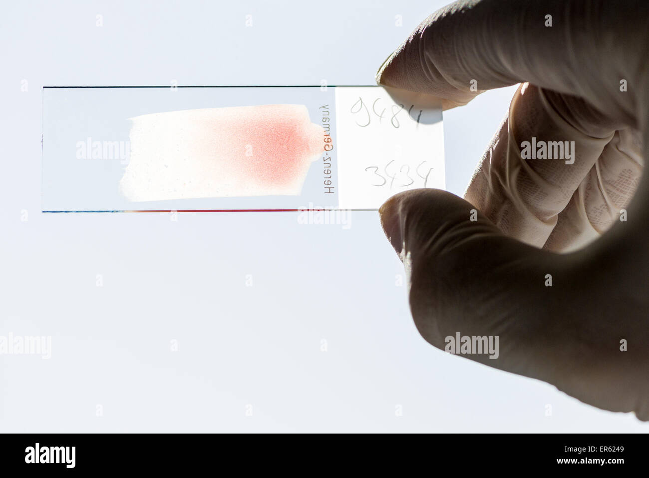 Macchie di sangue su un vetrino per la diagnosi, tenuto contro la luce in assistente di laboratorio la mano, Chemnitz, in Sassonia, Germania Foto Stock