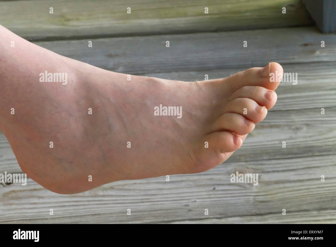 Chiusura Del Piede Nudo Di Un Uomo Di Mezza Eta Con Prominenti E Vene Varicose Al Di Fuori Su Di Un Ponte Di Legno Foto Stock Alamy