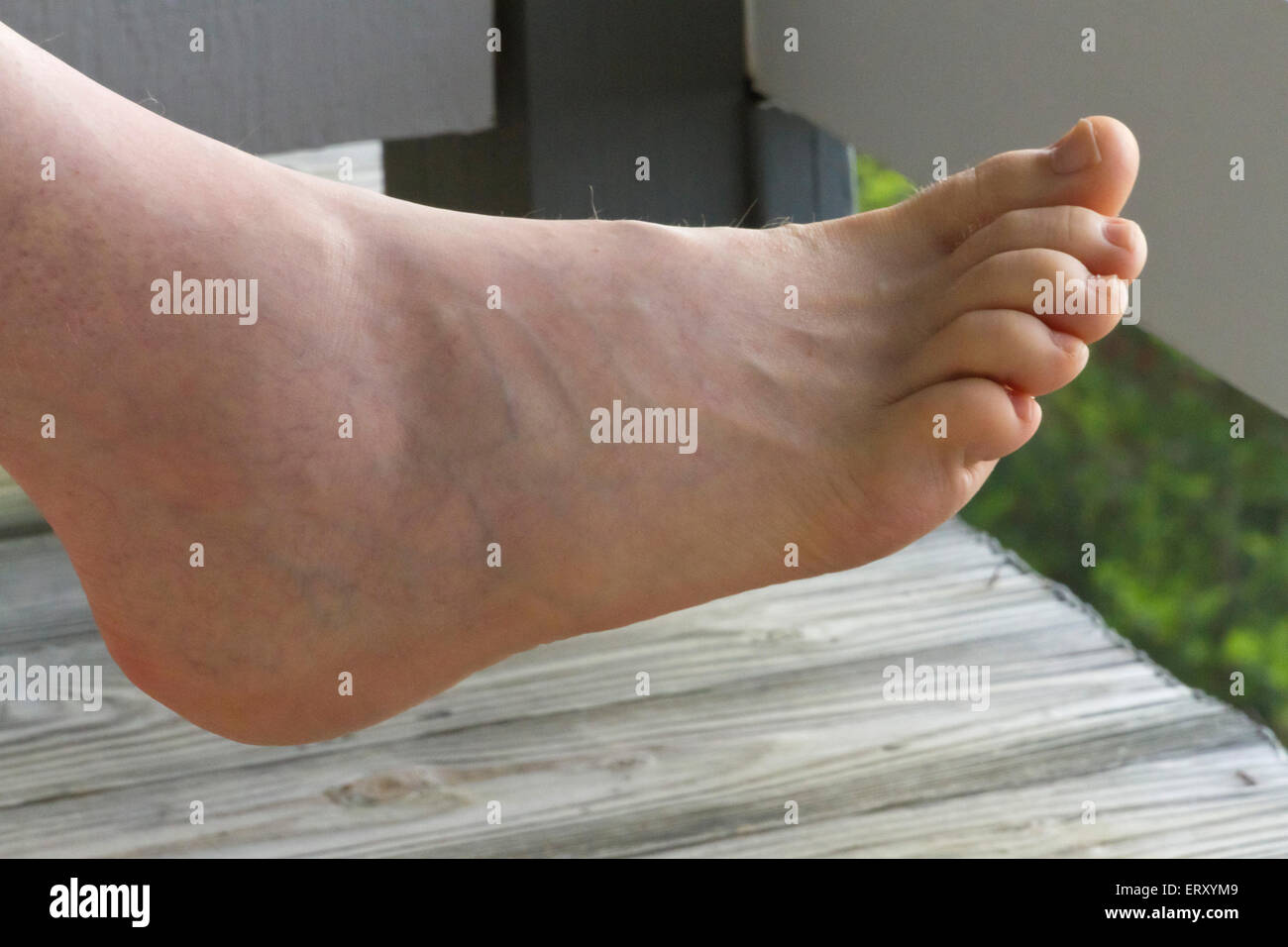 Chiusura Del Piede Nudo Di Un Uomo Di Mezza Eta Con Prominenti E Vene Varicose Foto Stock Alamy