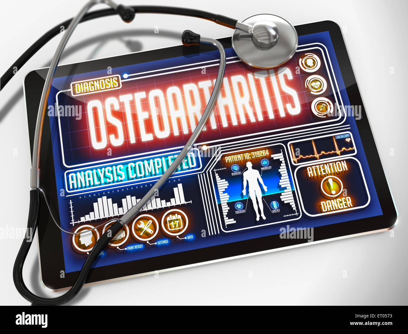 Osteoartrite sul display del Medical Tablet. Foto Stock