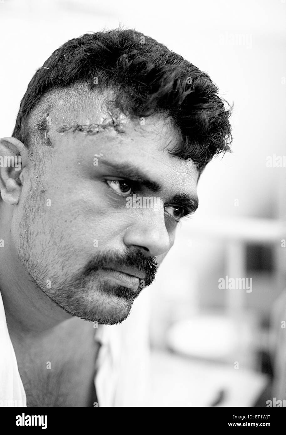 Abdul Rashid un cittadino ferito recuperando alla JJ ospedale durante le recenti esplosioni di bombe su 26 Novembre 2008 Mumbai Foto Stock