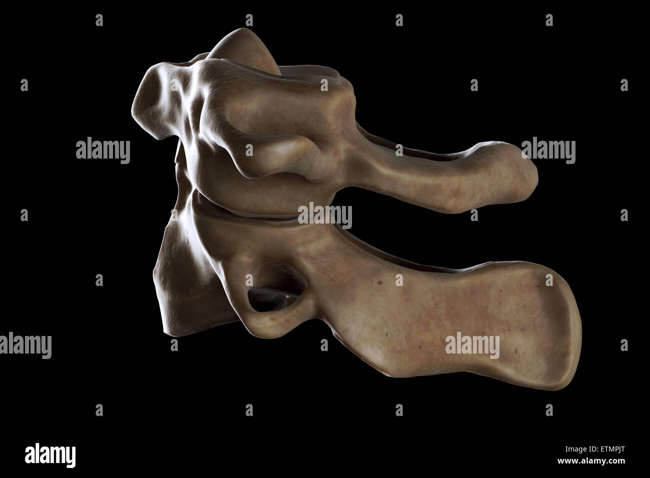 Illustrazione che mostra l'Atlas e asse vertebre del collo. Foto Stock