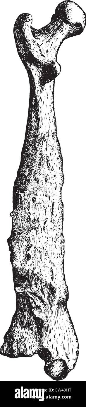 Femore, sezione longitudinale di osso, vintage illustrazioni incise. Illustrazione Vettoriale