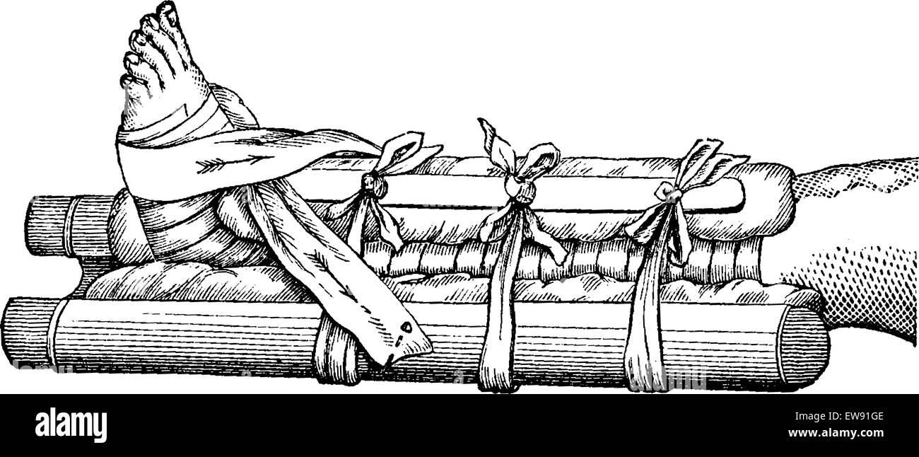 Completamente applicato fissatore Gamba, vintage illustrazioni incise. Al solito Dizionario medicina dal dr. Labarthe - 1885 Illustrazione Vettoriale