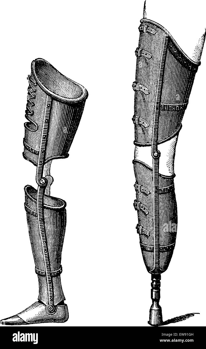 Gambe artificiali, mostrato con piede (sinistra) e con pestello (a destra), vintage illustrazioni incise. Al solito Dizionario medicina dal dr. Illustrazione Vettoriale