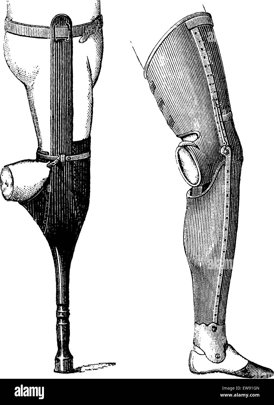 Gambe artificiali con pestello (sinistra) e con il piede (a destra) per sotto-ginocchio amputazione, vintage illustrazioni incise. Al solito Medicin Illustrazione Vettoriale