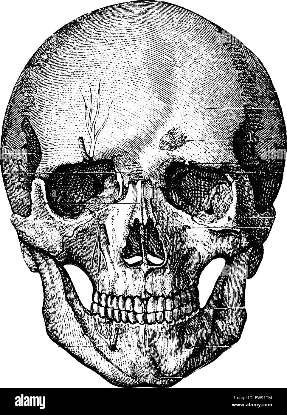 Lo scheletro osseo del volto e la parte anteriore del cranio, vintage illustrazioni incise. Al solito Dizionario medicina - Paolo La Illustrazione Vettoriale