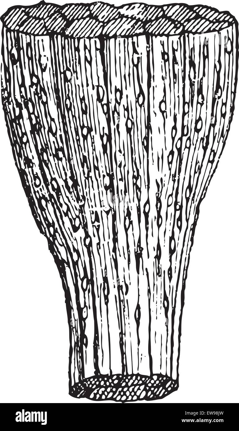 La trichinosi, mostrando le fibre del muscolo infettato con larve di Trichinella worm, vintage illustrazioni incise. Dizionario di parole Illustrazione Vettoriale