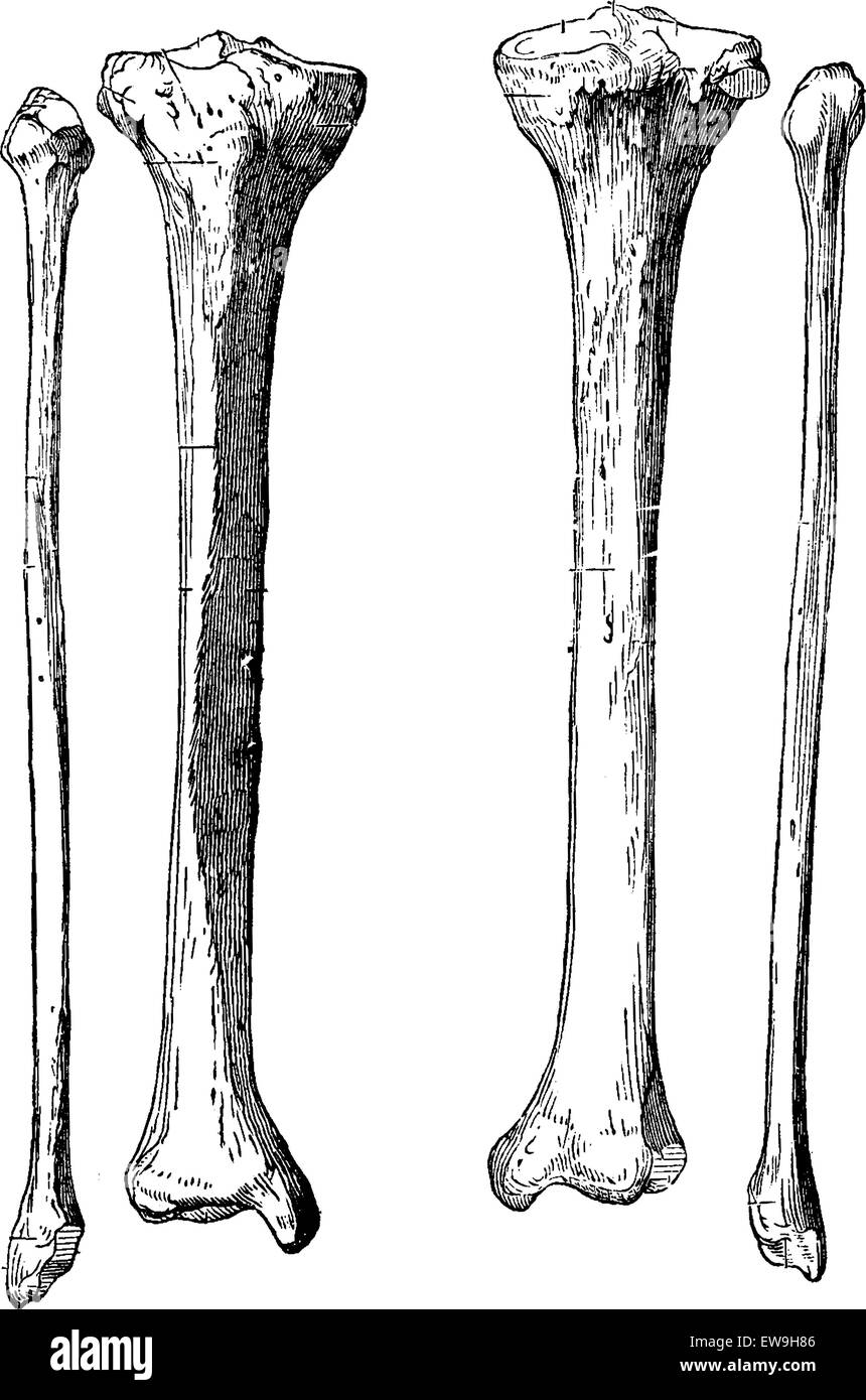 Gamba ossa tibia e perone, vintage illustrazioni incise. Al solito Dizionario medicina dal dr. Labarthe - 1885 Illustrazione Vettoriale