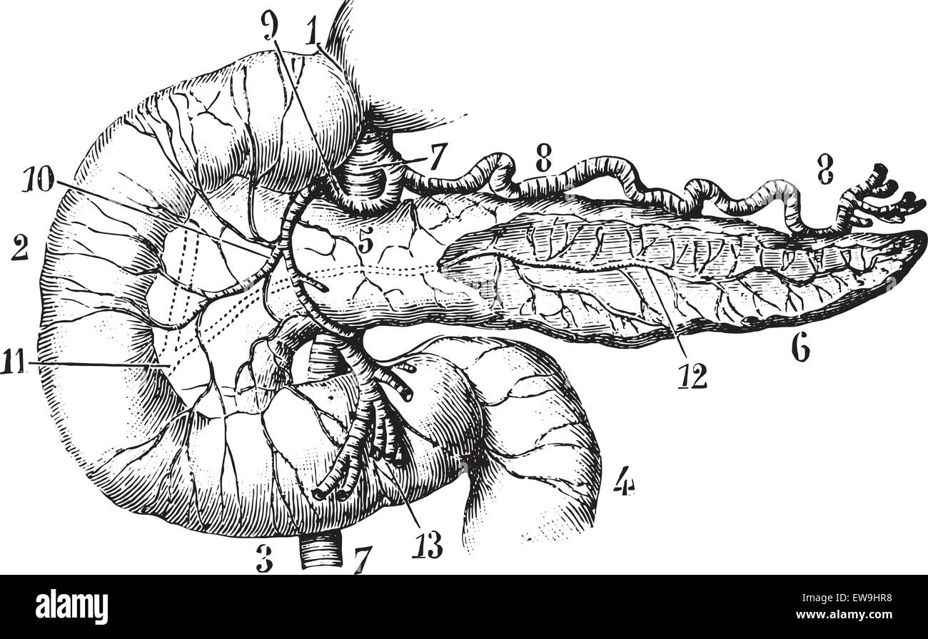 Il pancreas e il duodeno visto dal loro aspetto anteriore, vintage illustrazioni incise. Al solito Dizionario medicina - Paolo Labarthe - Illustrazione Vettoriale