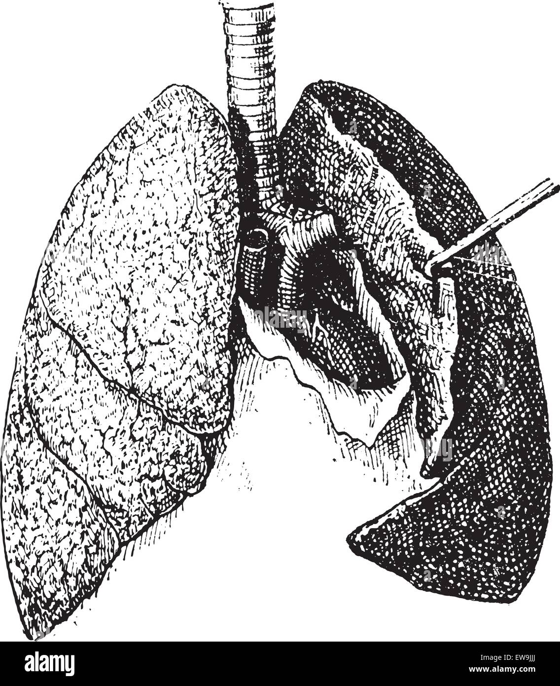 Vecchie illustrazioni incise di polmoni umani isolati su uno sfondo bianco. Dizionario di parole e le cose - Larive e Fleury ? 18 Illustrazione Vettoriale