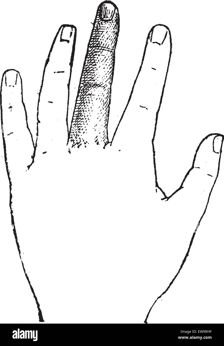 Human dito medio, vintage illustrazioni incise. Dizionario di parole e le cose - Larive e Fleury - 1895 Illustrazione Vettoriale