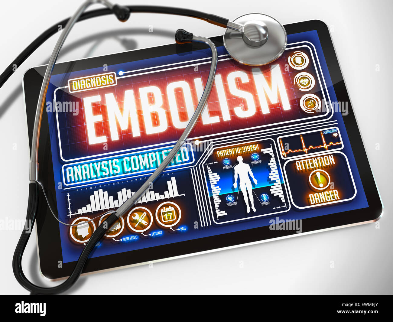 L'embolia sul display del Medical Tablet. Foto Stock