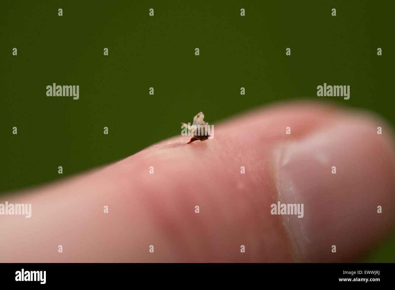 Bee sting - miele delle api (Apis) stinger, insieme con una parte del tratto digerente e dei nervi e dei muscoli in un dito umano Foto Stock
