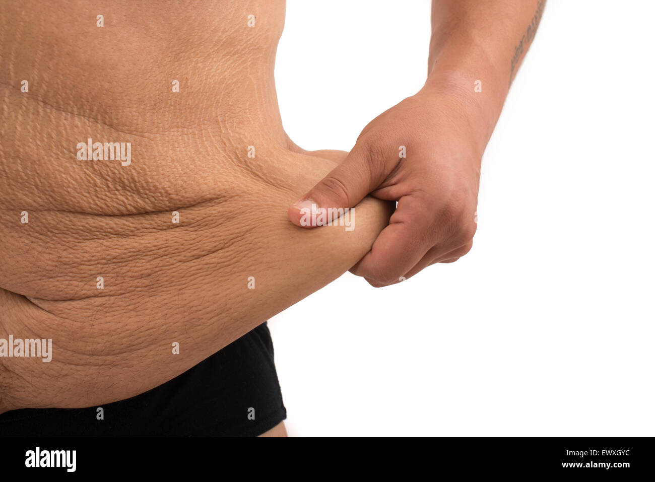 Uomo con grasso ventre e smagliature Foto stock - Alamy