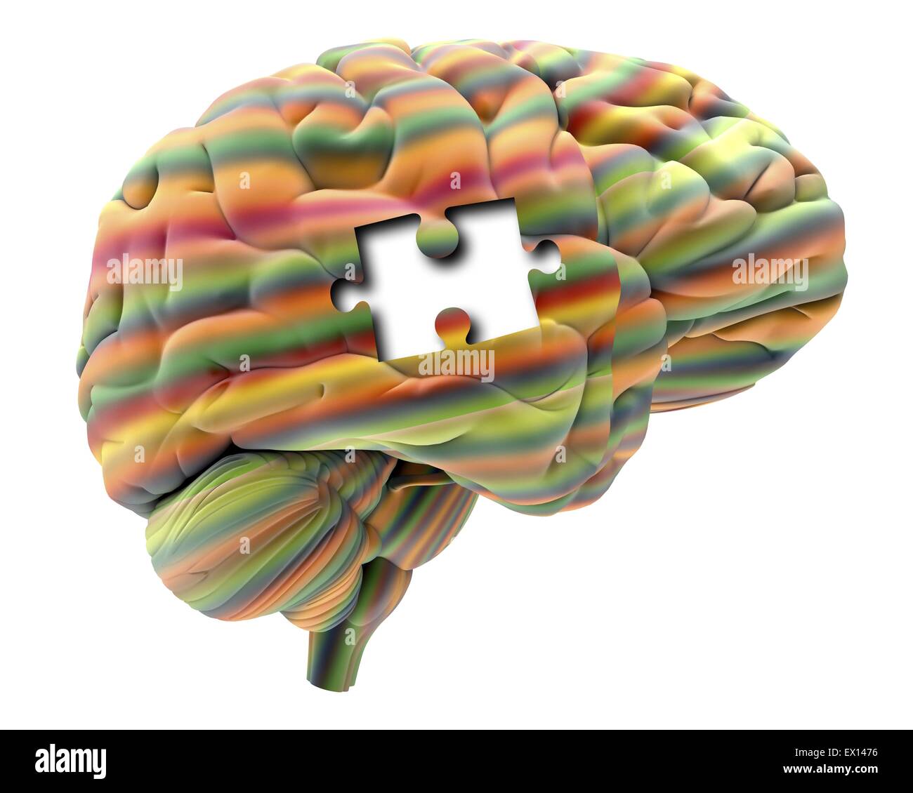 La perdita di memoria, concettuale computer grafica. Foto Stock