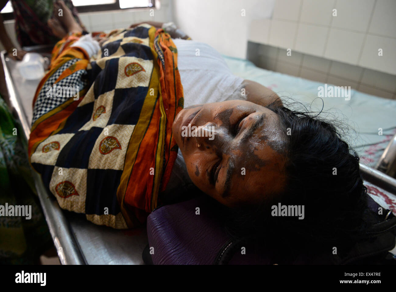 Dacca in Bangladesh. 6 Luglio, 2015. Sumuti Rani Das, 35, subì ustioni a Dhaka Medical College Hospital di un attacco acido. Sumuti Rani Das, 35, è stato inviato a Dhaka Medical College e ospedale dopo l attentato già il lunedì. Miscredenti ha gettato acido in loro attraverso la finestra attorno alle 3 del mattino a Gazipur vicino a Dacca in Bangladesh. Il 6 luglio 2015 Credit: Mamunur Rashid/Alamy Live News Foto Stock