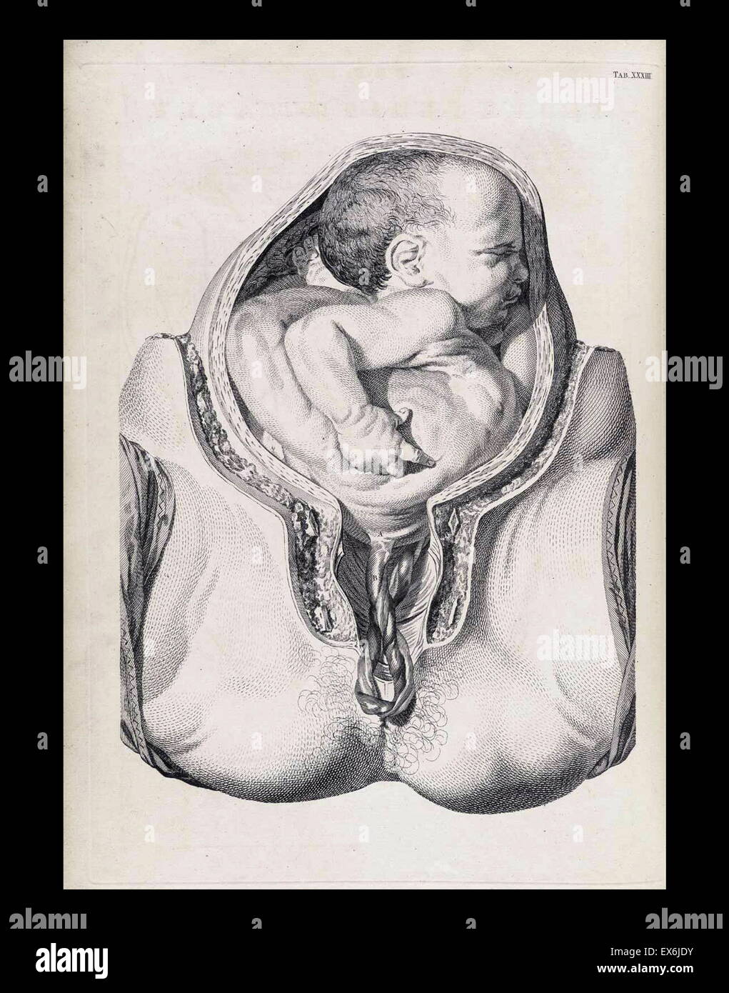 Illustrazione da 'Una sett di tavole anatomiche, con spiegazioni e un abridgment, della pratica di ostetricia". (Londra: 1754). Da William Smellie (1697 - 1763) un scozzese ostetrica Foto Stock