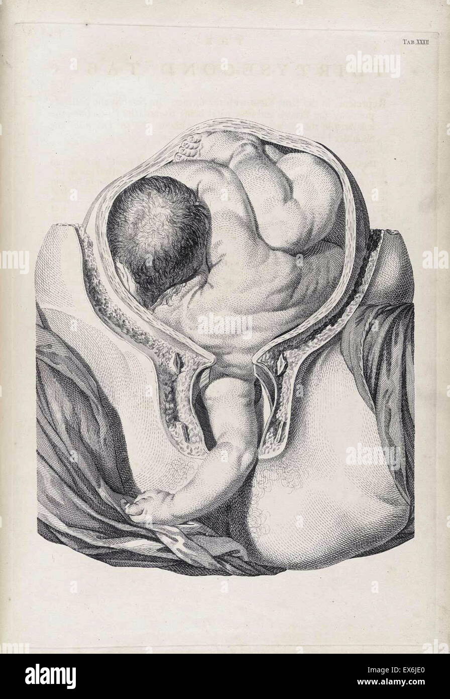 Illustrazione da 'Una sett di tavole anatomiche, con spiegazioni e un abridgment, della pratica di ostetricia". (Londra: 1754). Da William Smellie (1697 - 1763) un scozzese ostetrica Foto Stock
