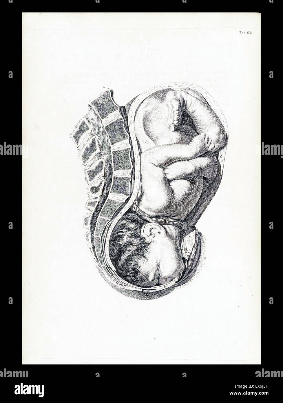 Illustrazione da 'Una sett di tavole anatomiche, con spiegazioni e un abridgment, della pratica di ostetricia". (Londra: 1754). Da William Smellie (1697 - 1763) un scozzese ostetrica Foto Stock