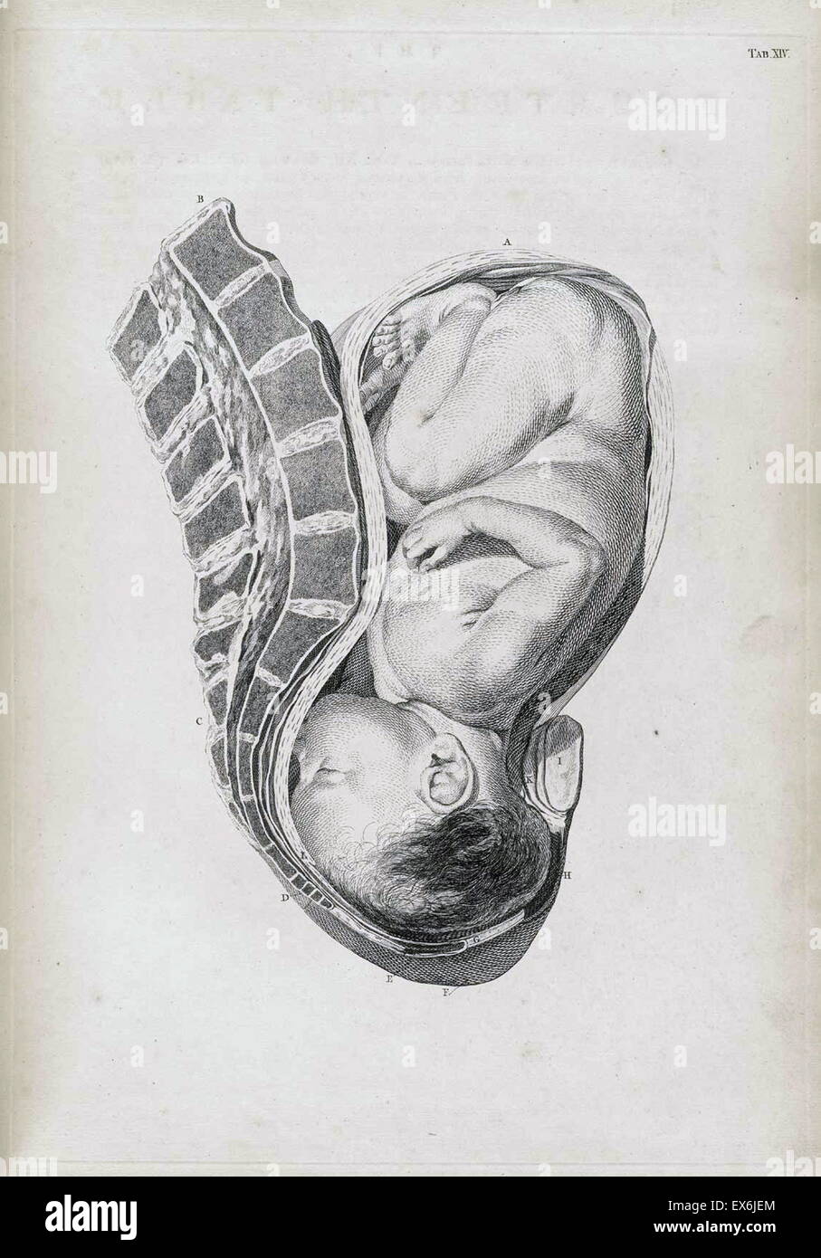 Illustrazione da 'Una sett di tavole anatomiche, con spiegazioni e un abridgment, della pratica di ostetricia". (Londra: 1754). Da William Smellie (1697 - 1763) un scozzese ostetrica Foto Stock