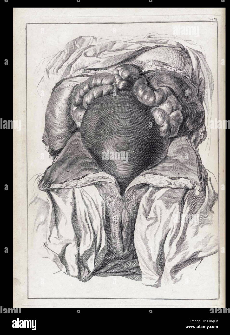 Illustrazione da 'Una sett di tavole anatomiche, con spiegazioni e un abridgment, della pratica di ostetricia". (Londra: 1754). Da William Smellie (1697 - 1763) un scozzese ostetrica Foto Stock
